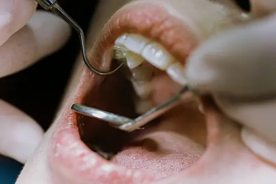 dentysta ogląda zęby